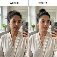 Retinal Glow Skin Firming Serum