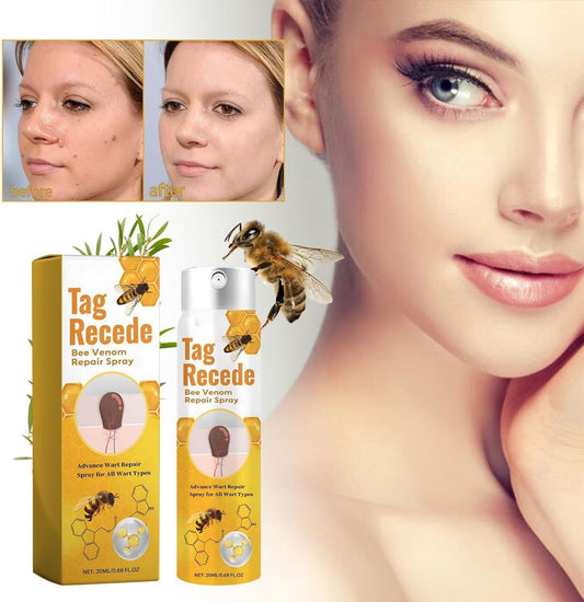 Tag Recede Bees Treatment Spray (P-Venom Spray) – Smooth Skin Protection | 20ml
