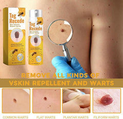 Tag Recede Bees Treatment Spray (P-Venom Spray) – Smooth Skin Protection | 20ml