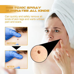 Tag Recede Bees Treatment Spray (P-Venom Spray) – Smooth Skin Protection | 20ml