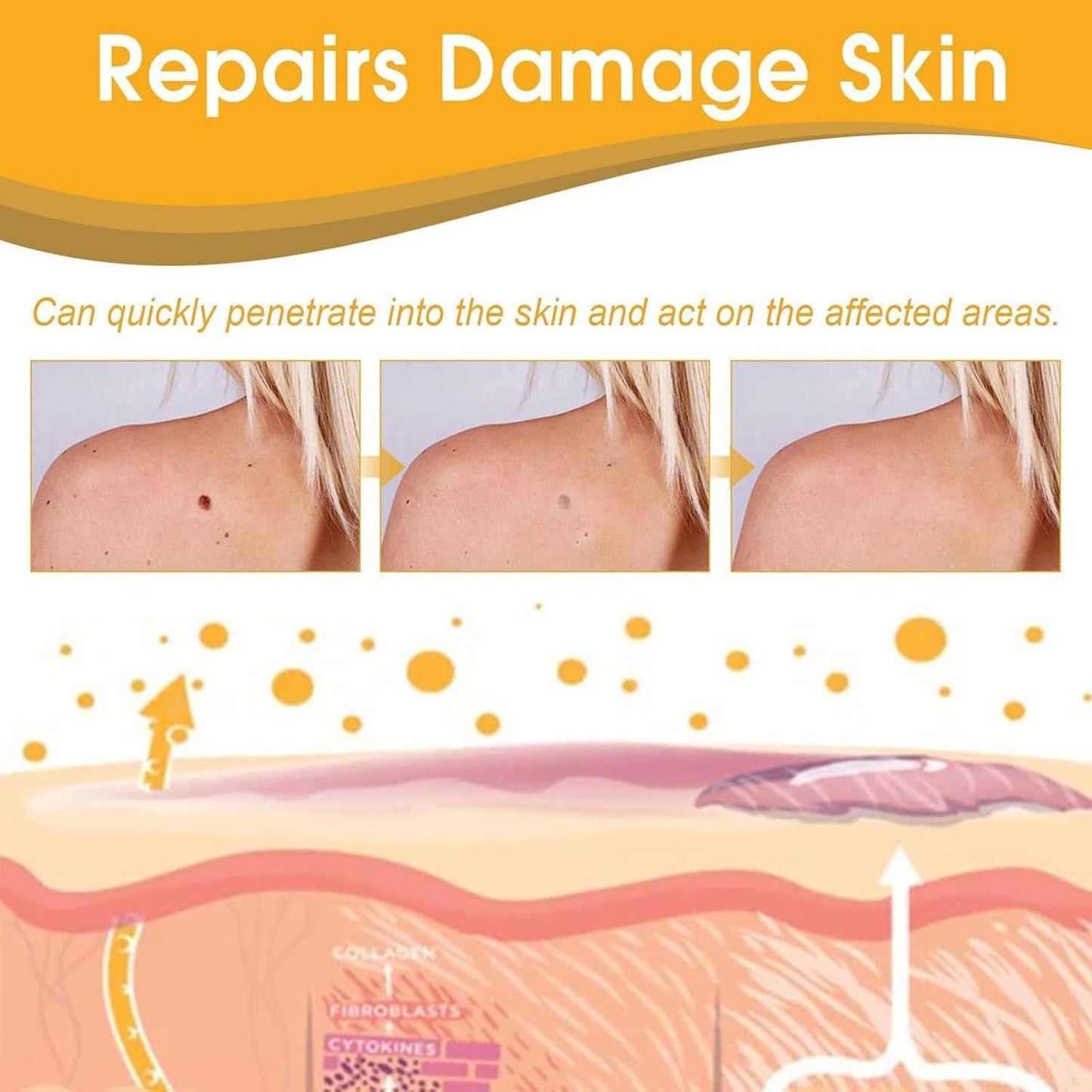 Tag Recede Bees Treatment Spray (P-Venom Spray) – Smooth Skin Protection | 20ml