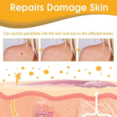Tag Recede Bees Treatment Spray (P-Venom Spray) – Smooth Skin Protection | 20ml