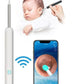Wireless Ear Wax Removal Tool with Camera – HD Ear Cleaning Endoscope for iPhone & Android