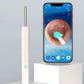 Wireless Ear Wax Removal Tool with Camera – HD Ear Cleaning Endoscope for iPhone & Android