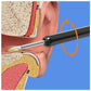 Wireless Ear Wax Removal Tool with Camera – HD Ear Cleaning Endoscope for iPhone & Android