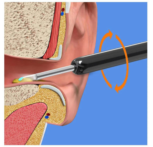 Wireless Ear Wax Removal Tool with Camera – HD Ear Cleaning Endoscope for iPhone & Android