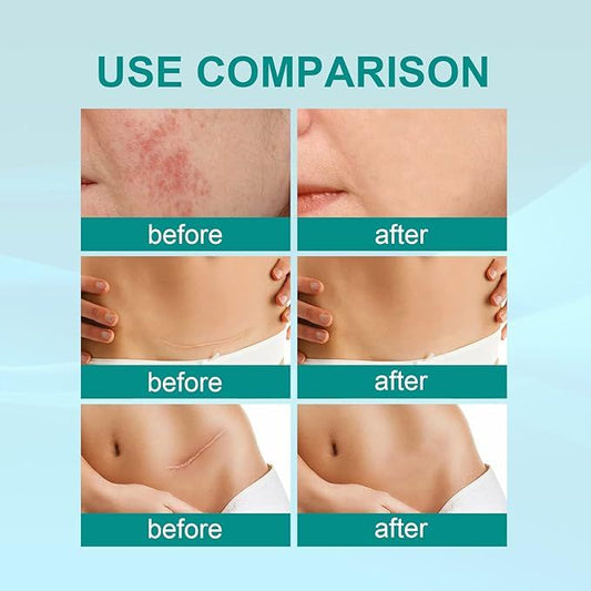 ProRegen Skin Texture Refining Mist